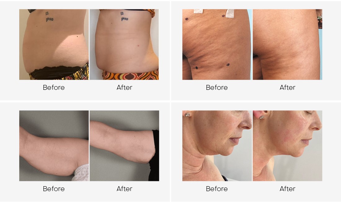 product-1100-652 product-1100-652